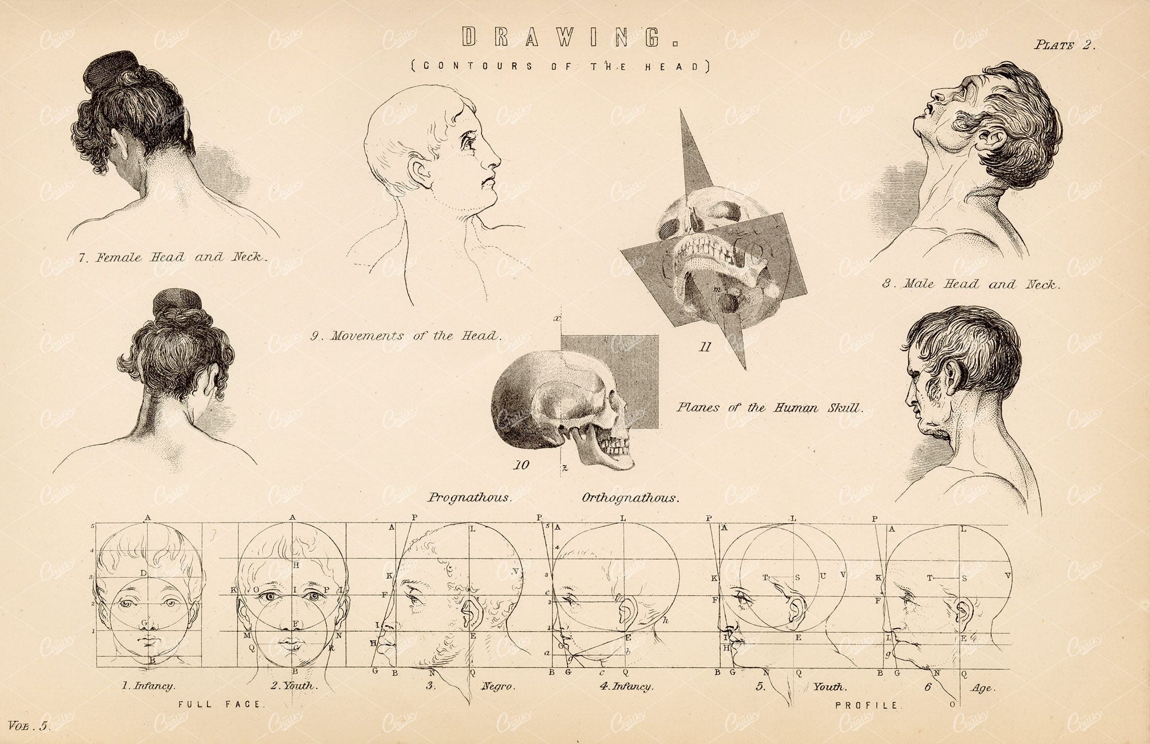 ANATOMY - Drawing (Contours of the Head) , Antique 1880 Print