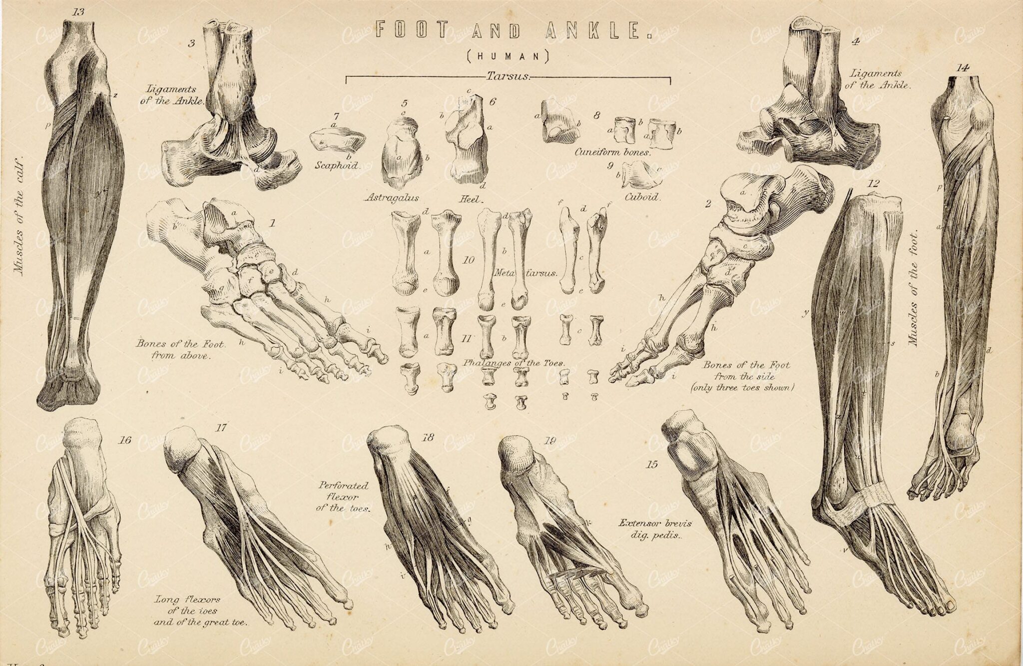 ANATOMY - Ligaments of Foot and Ankle - Antique 1880 Artwork