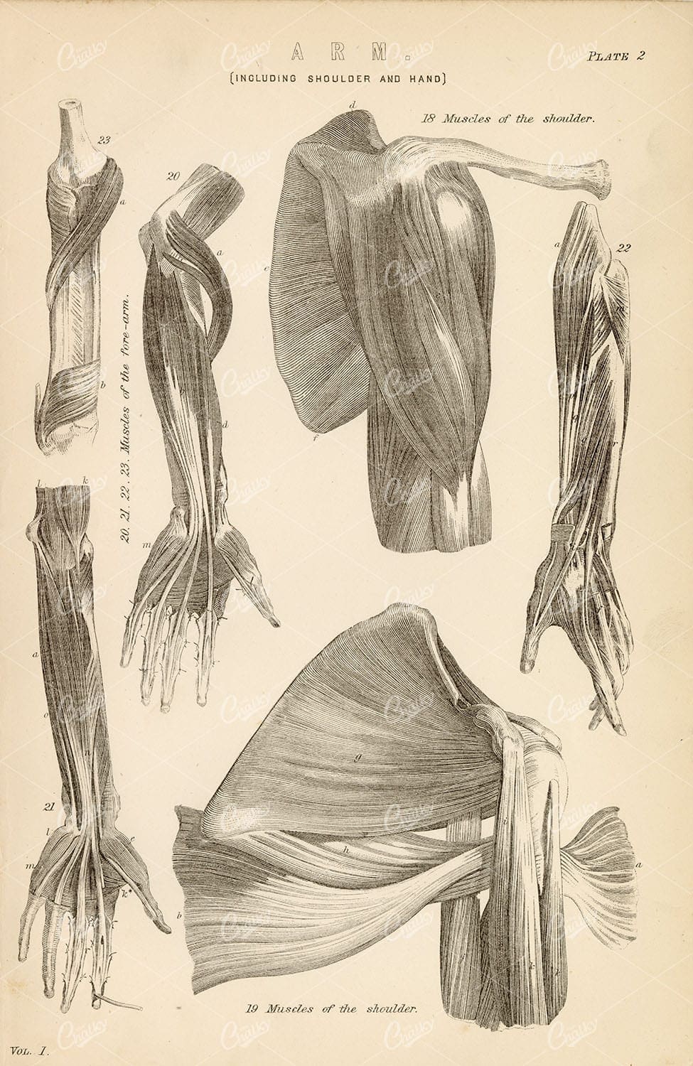 ANATOMY Various Arm Muscles, Including Shoulder and Hand. 1880's Artwork