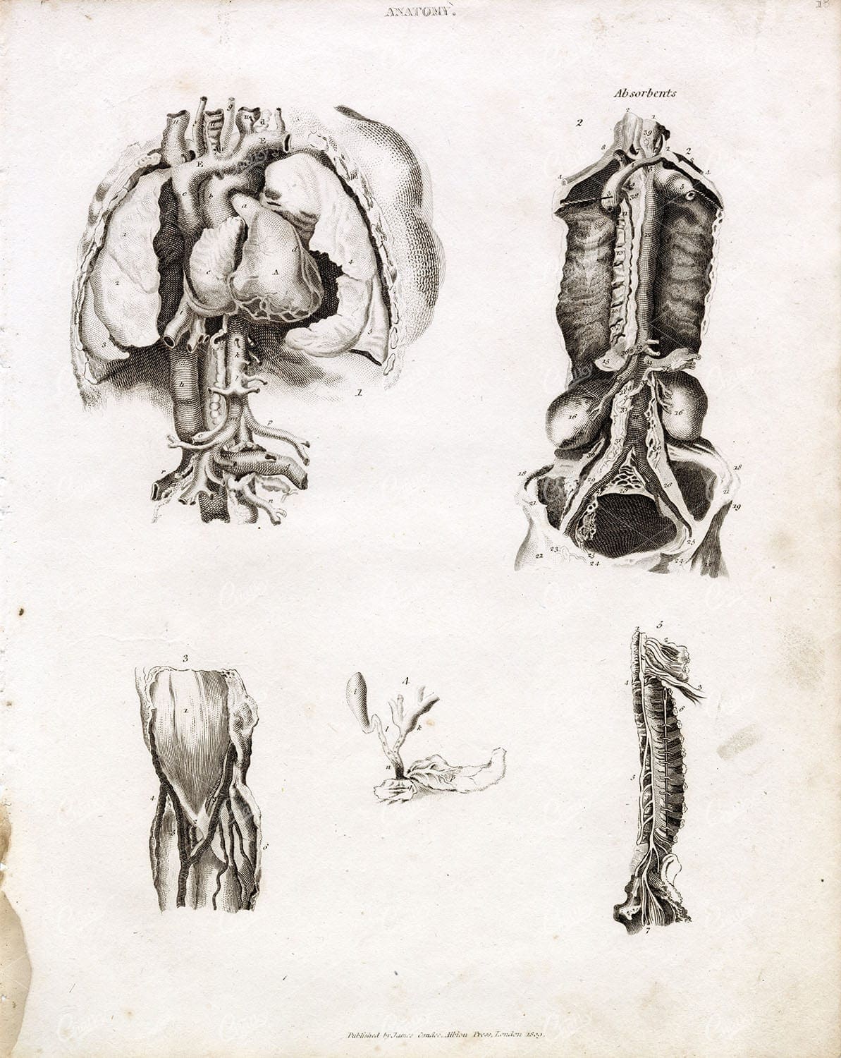 ANATOMY - Antique Human Organs Print - RARE 1800s Artwork