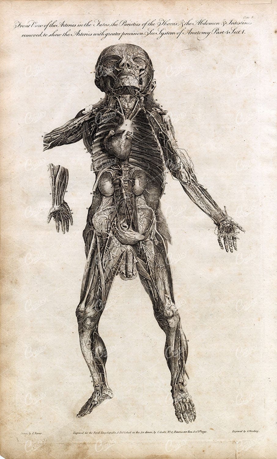 HUMAN ANATOMY - Front View of Arteries with Muscles Removed - Full Body