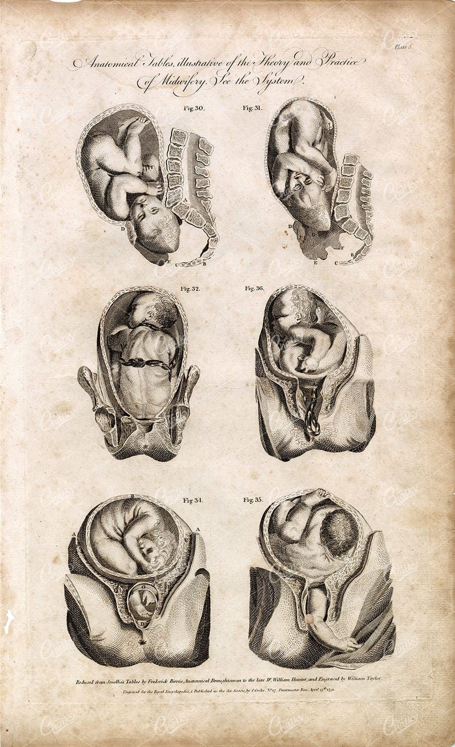 MIDWIFERY - Anatomical Illustrations - Theory and Practice - 1791 Print