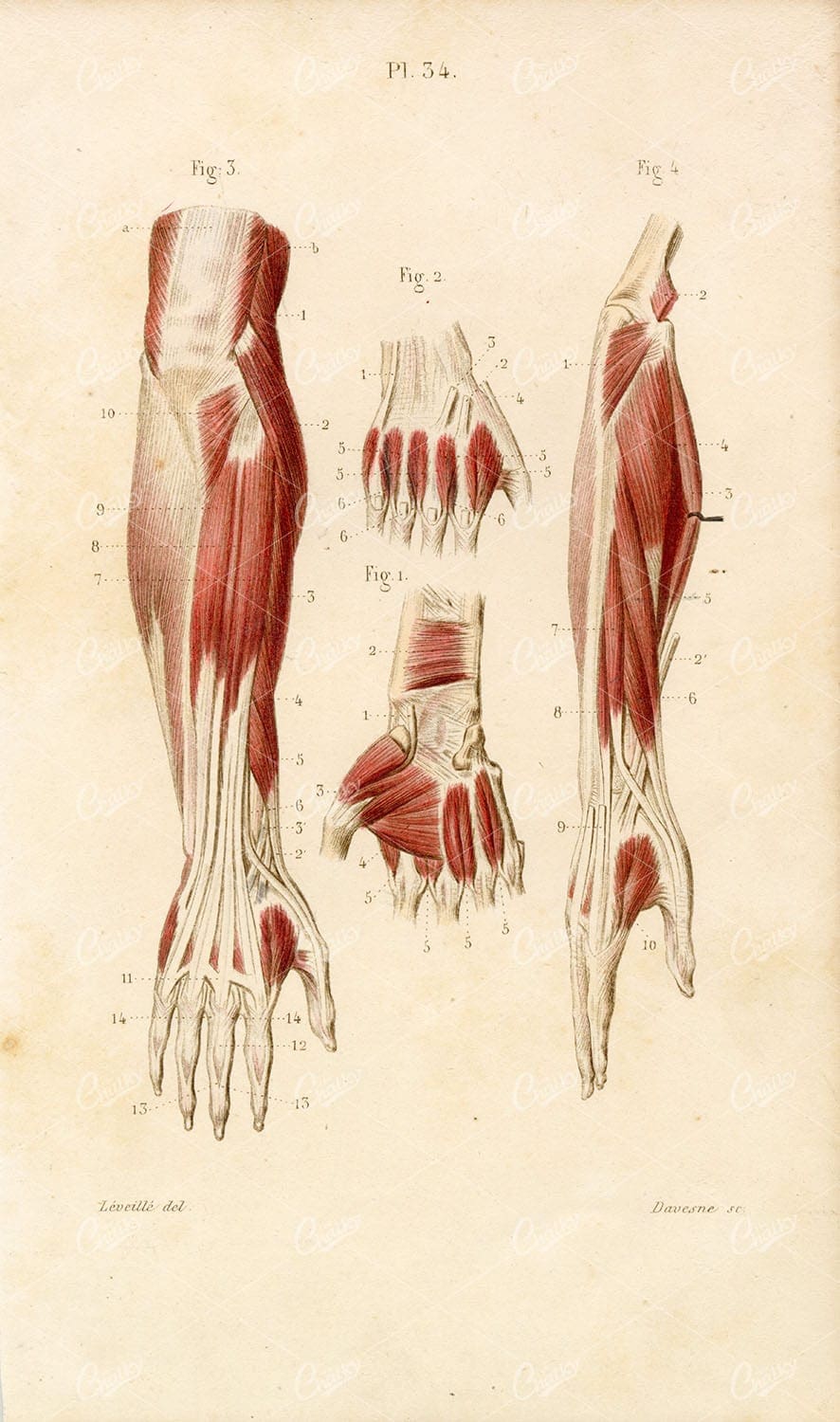 1867 ANATOMY Print - Forearm Hand Fingers Muscles Tendons Wrist Arm