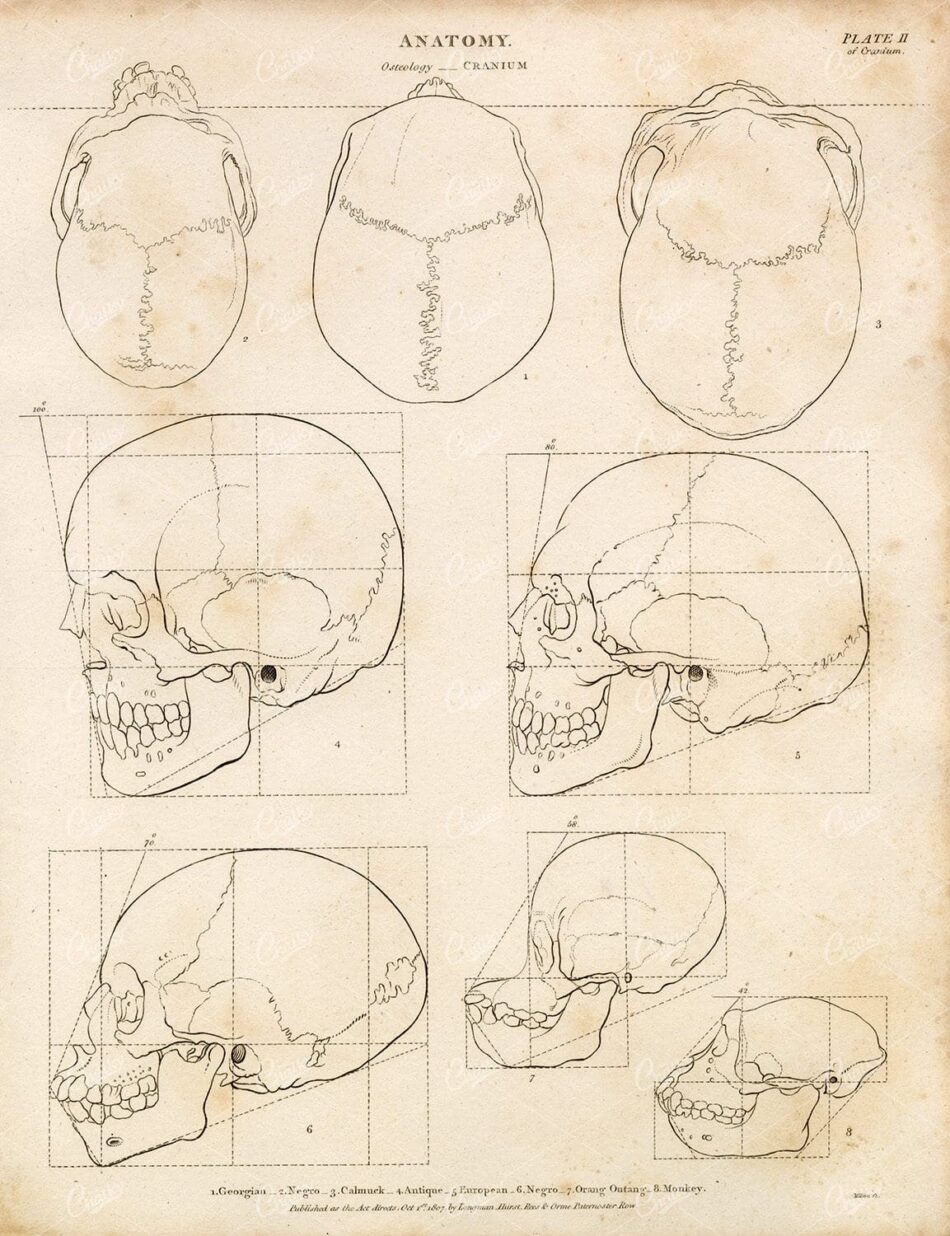 Skull Studies Of Human And Primate Crania - Top And Side Views With Sutures And Proportion Grids On Spotted Paper